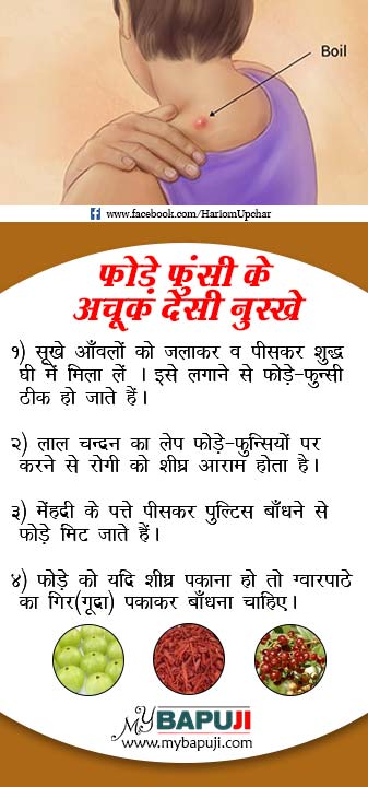 Health Tips in Hindi 93 Fode Funsi Ka Desi ilaj - Health Tips in Hindi